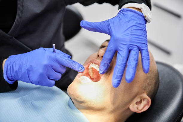Best Urgent Tooth Repair  in Oak Point, TX